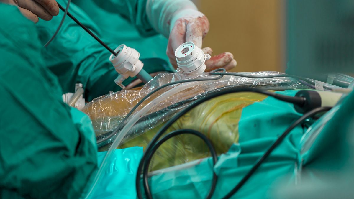 Persiapan Hingga Efek Samping Operasi Endometriosis