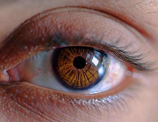 Penyebab Penglihatan Ganda atau Diplopia yang Mesti Diwaspadai