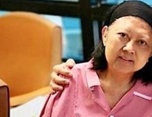 Efek Kemoterapi pada Wajah seperti Dialami Ibu Ani Yudhoyono