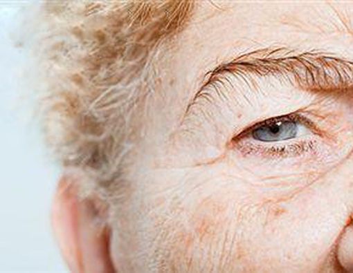 Kutil, Perlukah Diwaspadai?