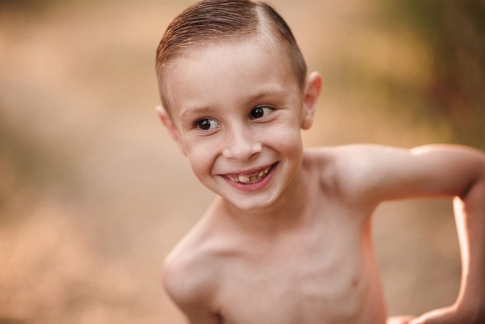 Dampak Malnutrisi Terhadap Pertumbuhan Anak