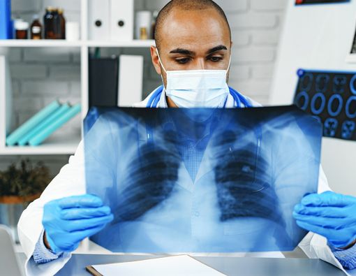 Hal-Hal yang Harus Dihindari Saat Pemulihan Kanker Paru