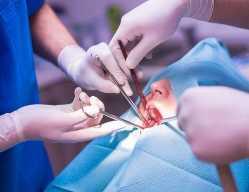 Awas, Ini Risiko Komplikasi Setelah Operasi Gigi Bungsu