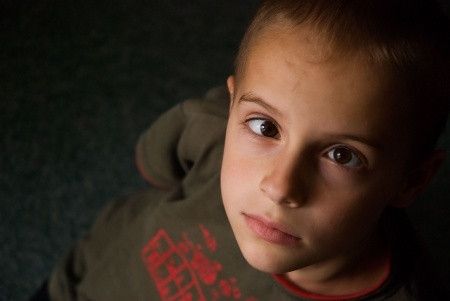 Sindrom Mata Malas atau Amblyopia