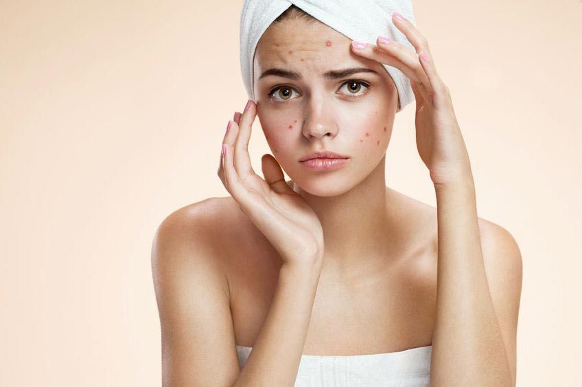 Tips Merawat Wajah untuk Kulit Sensitif