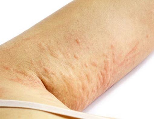 8 Masalah Kulit yang Sering Disepelekan 