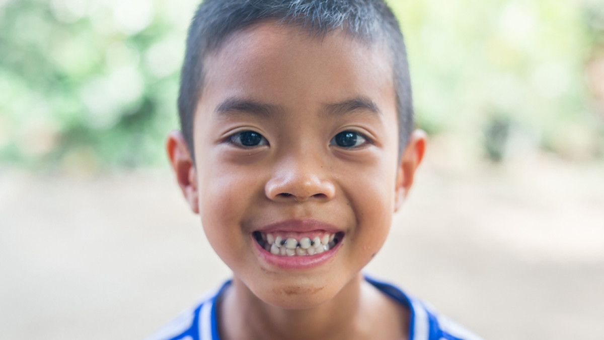 Penyebab Gigi Anak Hitam dan Cara Mengatasinya