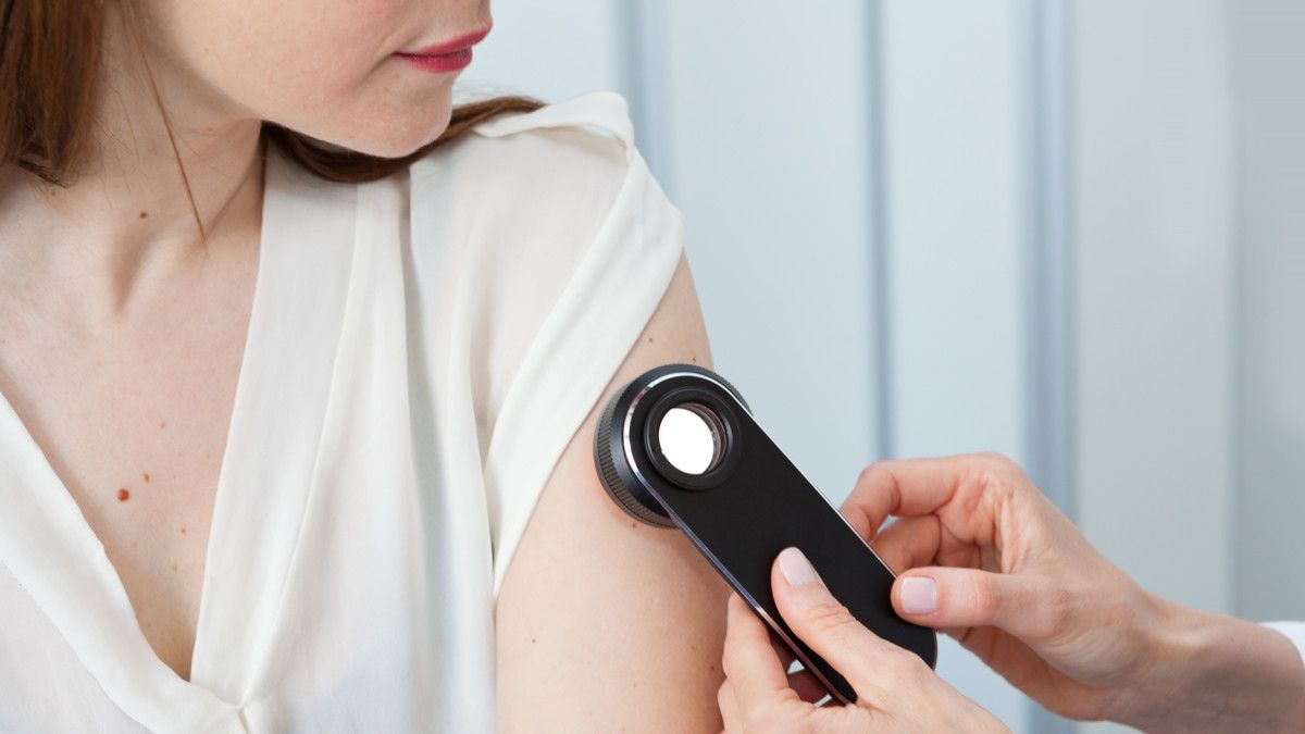 Mengapa Banyak Orang Enggan Periksa ke Dokter Kulit?