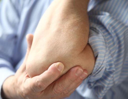 Jangan Keliru, Ini Perbedaan Bursitis dan Tendinitis