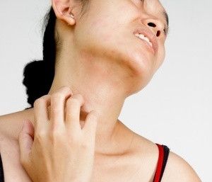 5 Barang Rumah Penyebab Iritasi Kulit