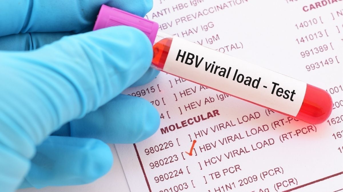 Mengenal Tes Viral Load untuk Mendeteksi Hepatitis C