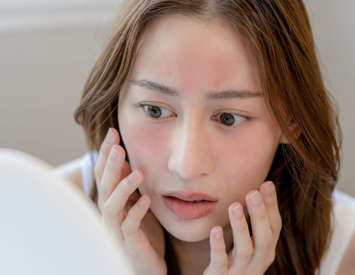 Cara Menghilangkan Gatal Merah di Wajah karena Kosmetik