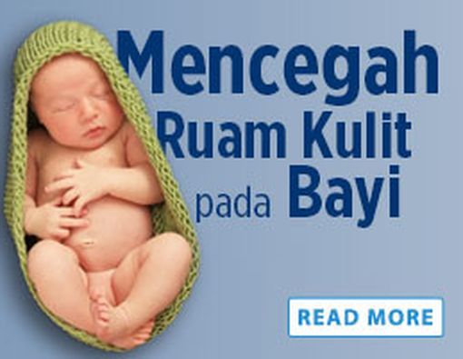 Mencegah Ruam Kulit Pada Bayi