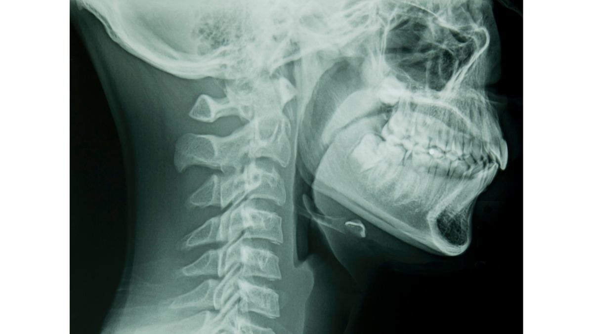 Mengenal Deretan Fungsi Faring pada Tubuh Manusia - KlikDokter