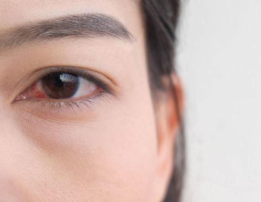 Berbagai Pemeriksaan dalam Mendiagnosis Glaukoma