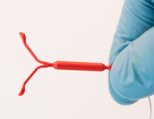 Langkah-langkah Pemasangan Alat Kontrasepsi IUD atau KB Spiral