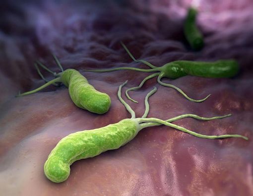 Maag Akibat Infeksi Bakteri, Mungkinkah?