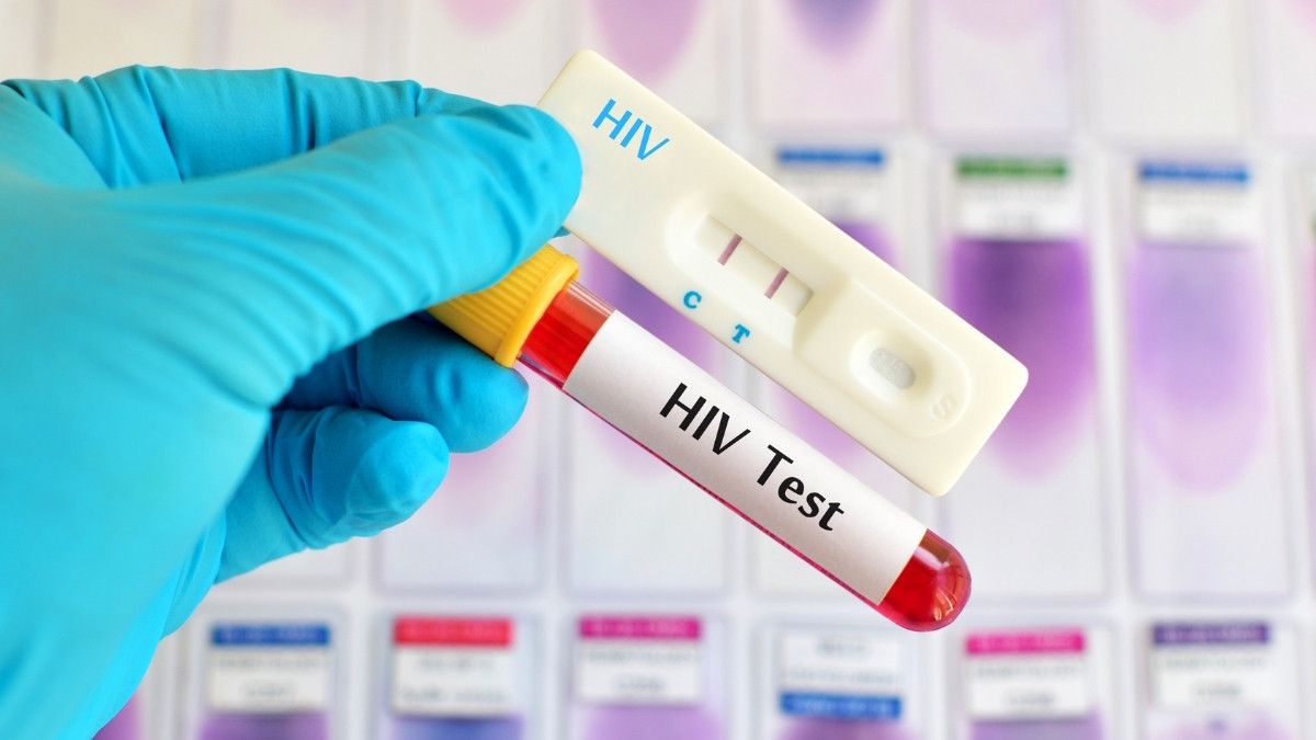 Panduan Menjalani Tes HIV di Puskesmas KlikDokter