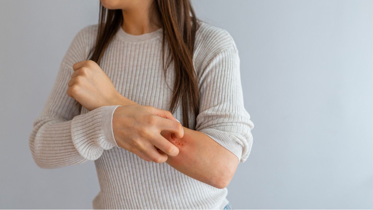 Psoriasis Bisa Tingkatkan Risiko Penyakit Jantung, Benarkah?