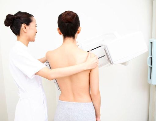 Benarkah Kanker Payudara Dapat Terjadi pada Wanita Muda?