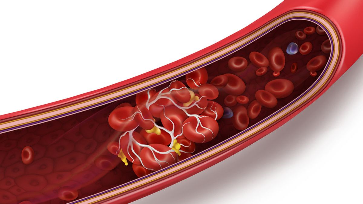 Ilustrasi Pembekuan Darah