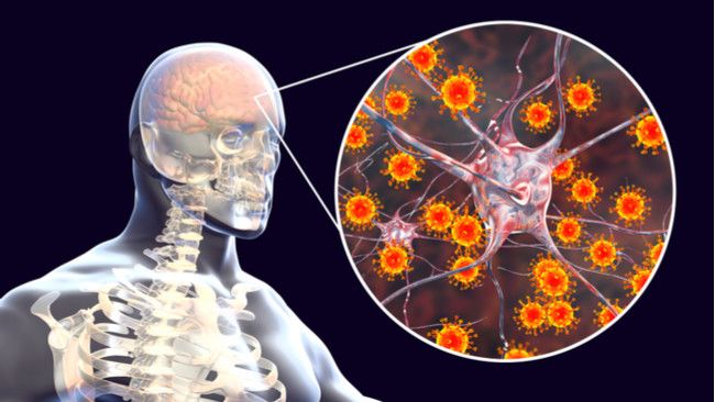 Ini yang Terjadi pada Tubuh Pasca Meningitis