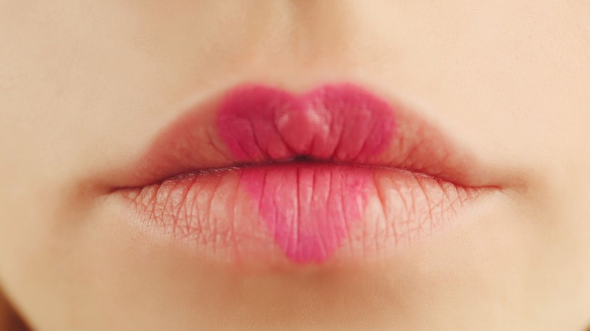 Hati-Hati, Ini Penyebab Bercak Hitam di Bibir