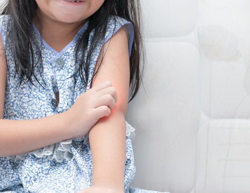 Kenali Hal-Hal yang Dapat Melemahkan Imunitas Kulit