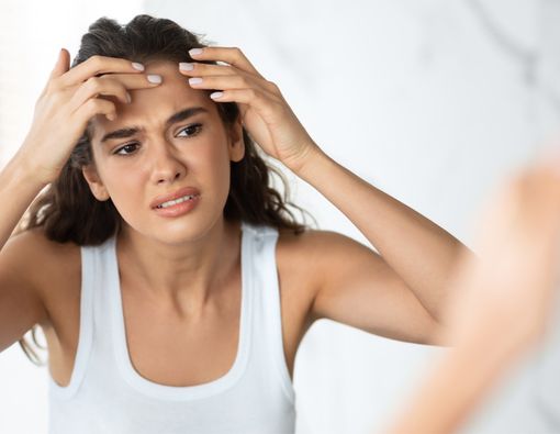 Punya Fungal Acne? Hindari Kandungan Skincare Ini