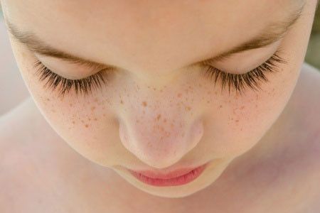 Cara Pudarkan Flek Hitam Tanpa Krim Wajah