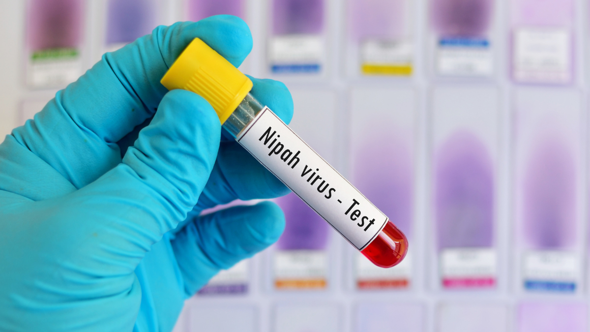 Infeksi Virus Nipah