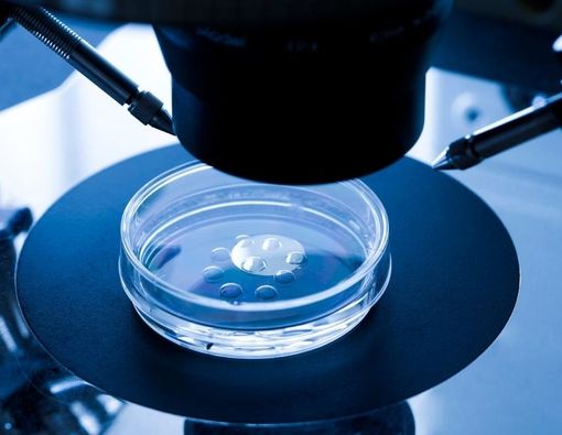IVF Tingkatkan Risiko Kanker Payudara pada Wanita, Benarkah?