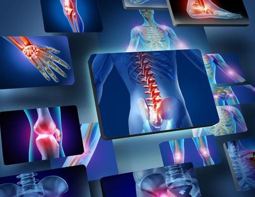 Seputar Radang Sendi