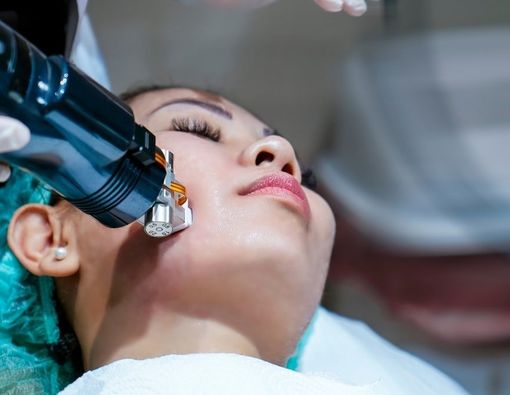 Manfaat Terapi Radiofrequency untuk Kecantikan
