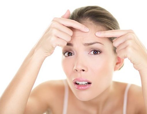 Jerawat Pada Orang Dewasa