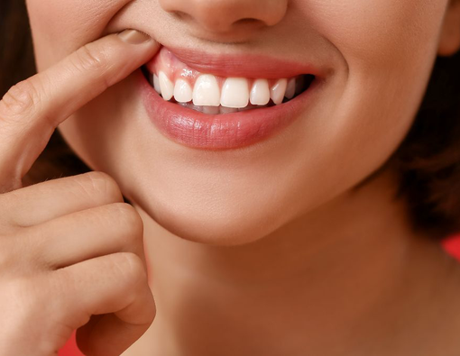 Cara Mengatasi Masalah Gusi Hitam