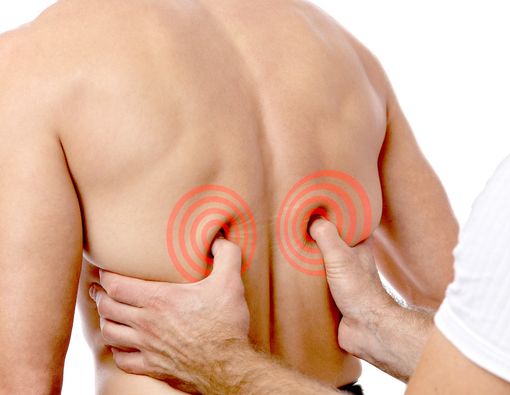 Ini Bedanya Akupunktur dan Akupresur