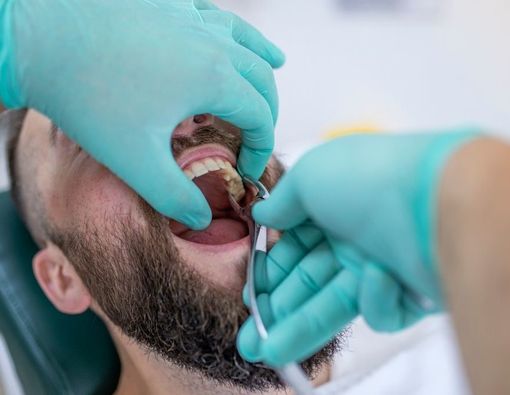 Bahaya Langsung Merokok Setelah Cabut Gigi