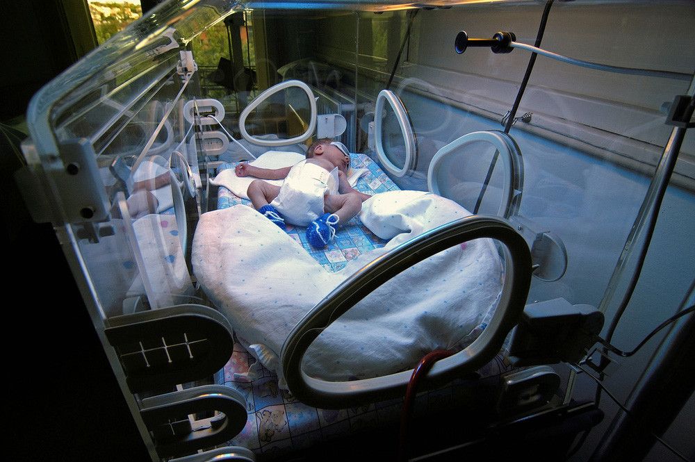 Mengapa Bayi Prematur Perlu Dirawat di Rumah Sakit?