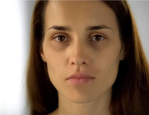 Cara Efektif Menghilangkan Mata Panda