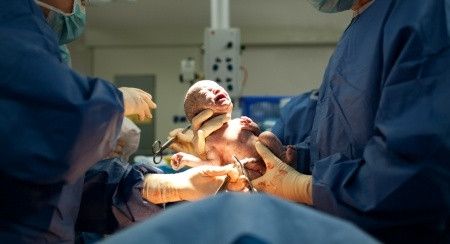 4 Sebab Dokter Anjurkan Kelahiran dengan Operasi Sesar