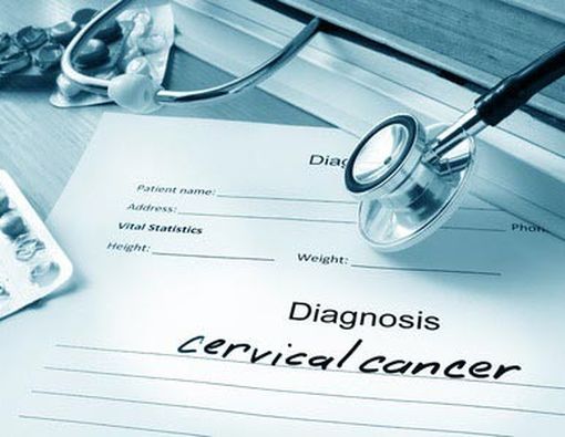 10 Gejala Kanker Serviks yang Harus Anda Waspadai