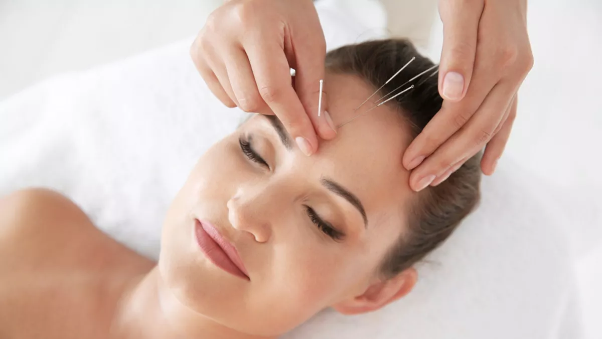 Benarkah Pengobatan Akupunktur Bisa Atasi Insomnia?