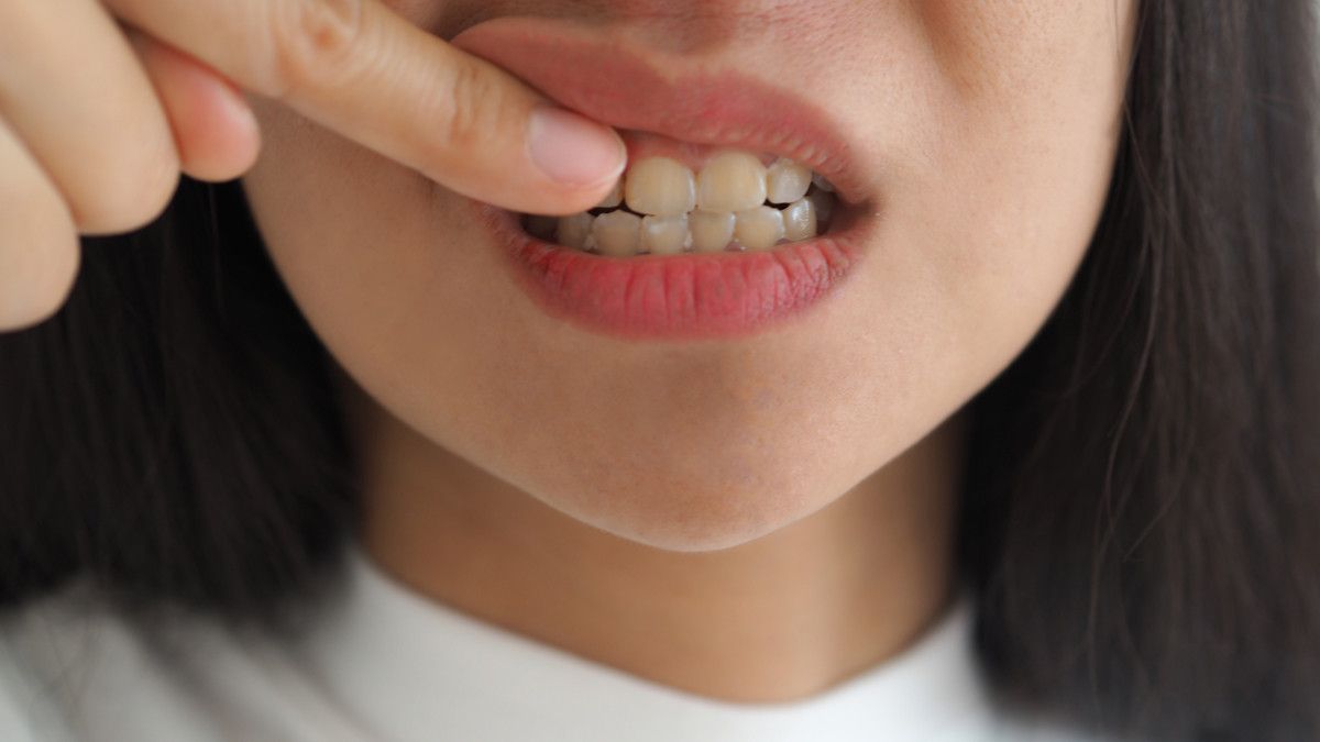 Kenali 5 Penyebab Makanan Nyangkut di Gigi