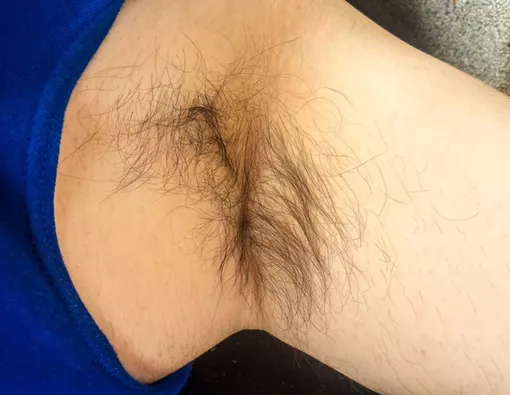 Ini Manfaat Bulu Ketiak bagi Manusia