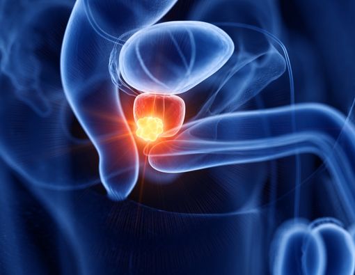 Mencegah Kanker Prostat dengan Makan Jamur, Efektifkah?