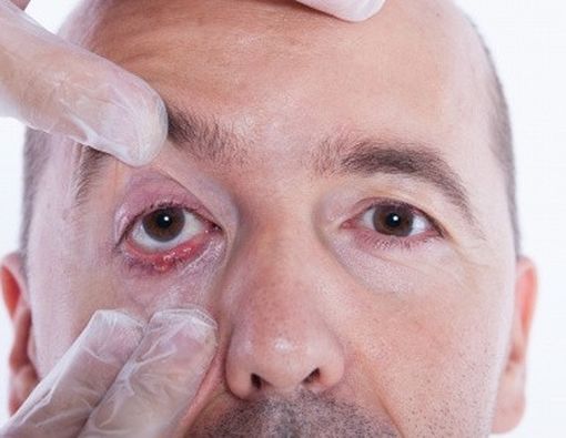 Hal yang Pertama Dilakukan Saat Mulai Bintitan