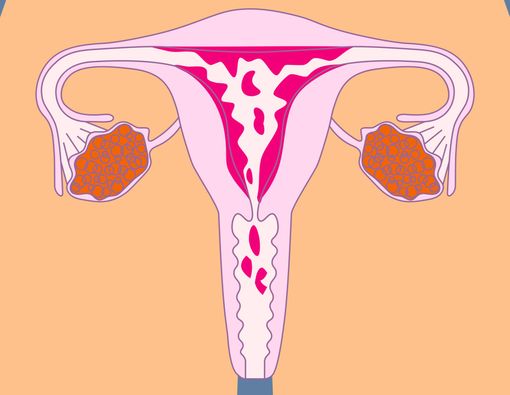 12 Fakta Haid yang Wajib Diketahui Wanita