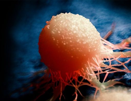 Jangan Keliru, Kenali Beda Kista dan Tumor