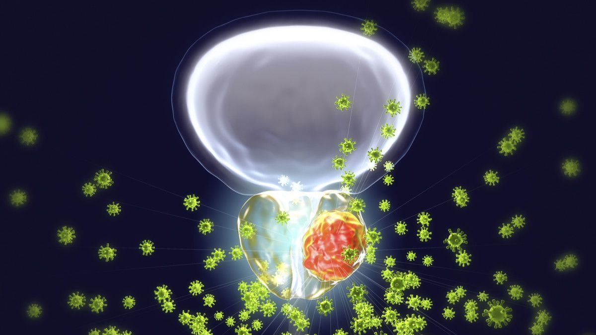 Ditemukan Hubungan Virus Dengan Kanker Prostat